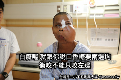 這是史蒂夫 躺在病床2年  白癡喔 就跟你說口香糖要兩邊均衡咬不能只咬左邊