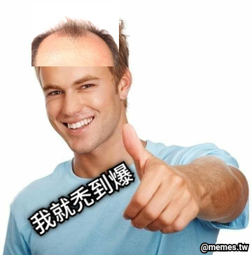 我就禿到爆