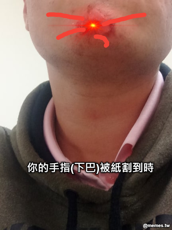 你的手指(下巴)被紙割到時