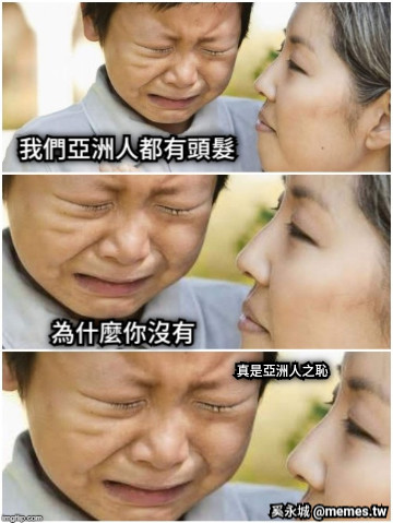 我們亞洲人都有頭髮 為什麼你沒有 真是亞洲人之恥