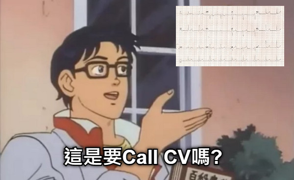 這是要Call CV嗎?
